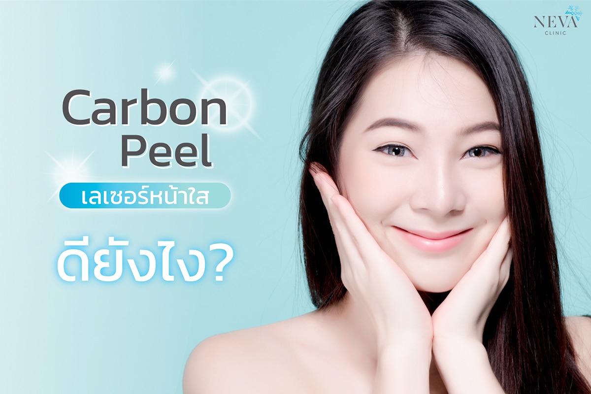 You are currently viewing Carbon Peel เลเซอร์หน้าใส ดียังไง?